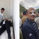 Ombudsman launches an investigation into excessive use of force against Strpce residents protesting against the construction of MHPP Povređeni Štrpce