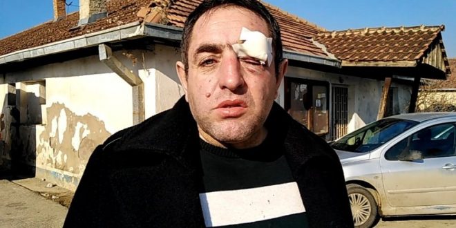 Pretučen vozač