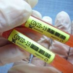 Još sedam novih slučajeva koronavirusa na Kosovu, ukupno 86 Korona Virus
