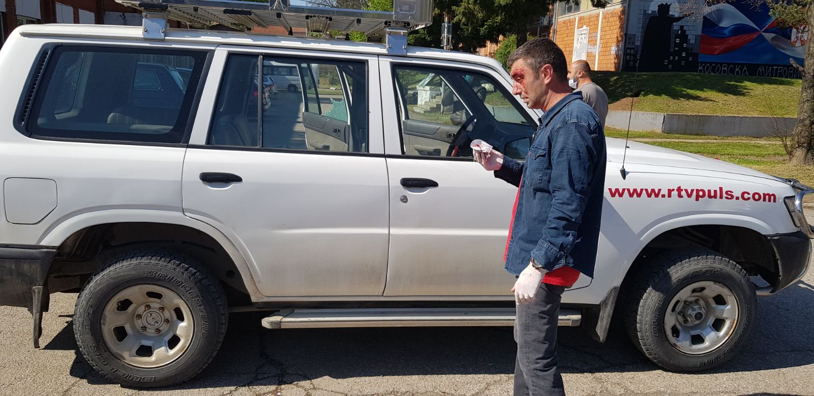 Nenad Milenković napadnut u Kosovskoj Mitrovici