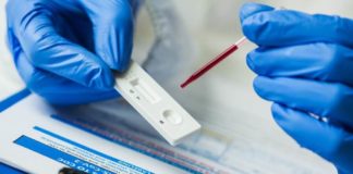 PCR testovi