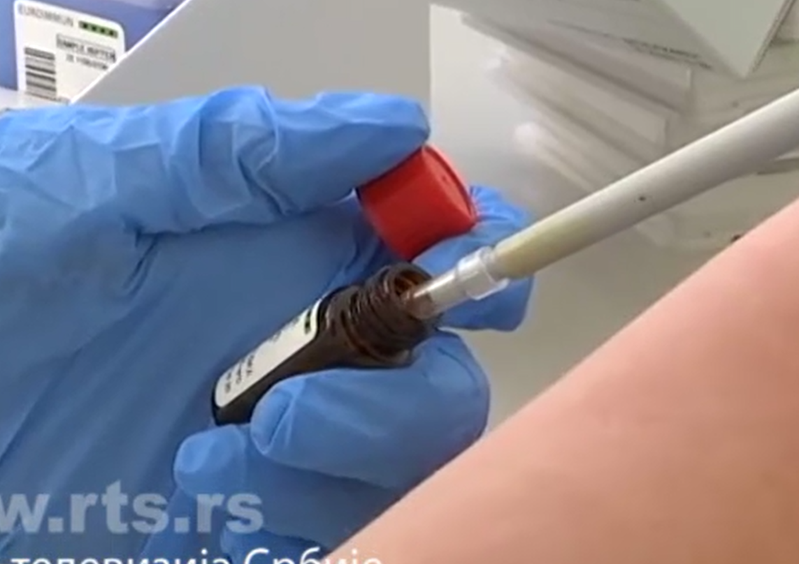 Srpski test na koronavirus