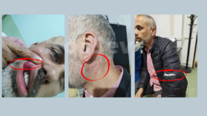Mitrovica Resident Alleges Police Abuse