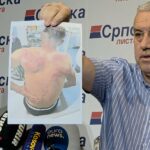 Srpska lista: Pokušaj ubistva Raškovića, još sedam ljudi pretučeno, ovo je okupacija FOTO: KoSSev/Elek